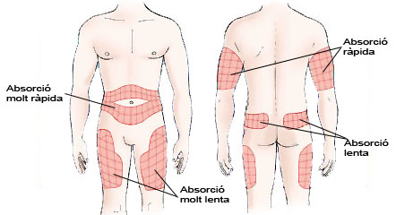 Imatge on s'especifica la velocitat d'absorció de la insulina en funció de la zona d'administració