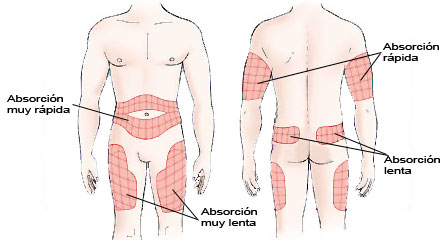 Imagen donde se especifica la velocidad de absorción de la insulina en función de la zona de administración