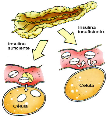 Insulina