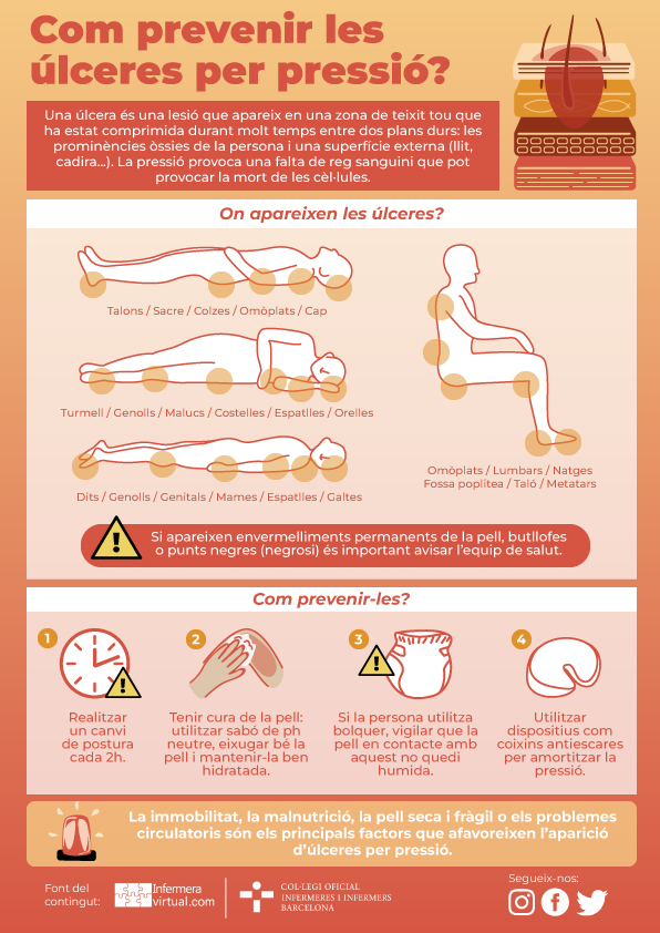 Infografia Ulceres pressió