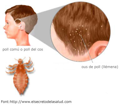 PollS en el cap