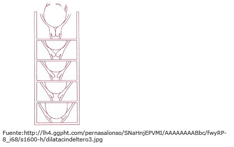 Borrado y dilatación del cuello uterino