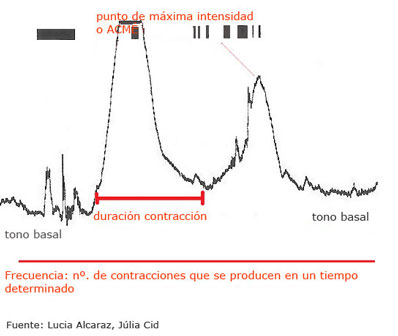 Gráfica de una contracción