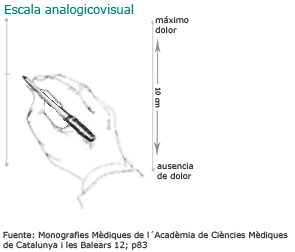 Escala analogicovisual: Mano con un bolígrafo para hacer un gráfico del dolor sobre un papel